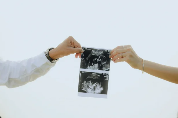 Couple holding ultrasound image of their baby, symbolizing new beginnings and parenthood.